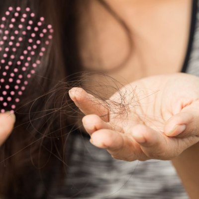 Perdida del cabello