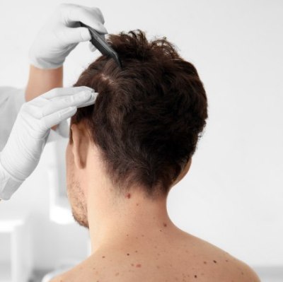 Restauración de cabello